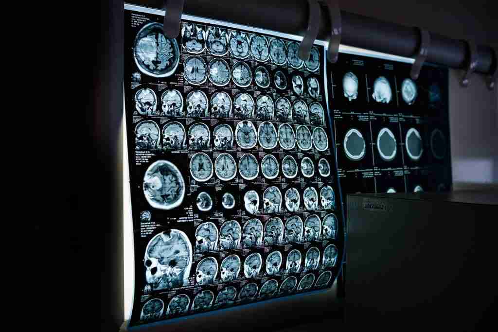 La Tomografia Computerizzata (TC) di Ultima Generazione nelle Strutture Sanitarie Private: Una Rivoluzione nell'Imaging Diagnostico